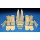 1/72 Rockwell B-1B Lancer Late Exhaust and Rear Nacelle Set for Monogram kit